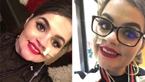 Emily Jones, a 22-year-old British who has a medical condition called Ehlers-Danlos syndrome (type 3).(Instagram/beautybyemilylou_)