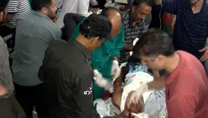 One of the passengers injured in the terror attack on a pilgrims’ Monday in Anantnag in Jammu and Kashmir.(PTI) One of the passengers injured in the terror attack on a pilgrims’ Monday in Anantnag in Jammu and Kashmir.(PTI)