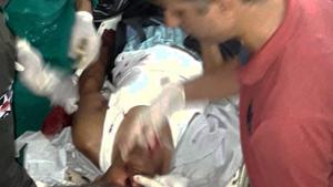 An injured Amarnath yatri being treated at a hospital after militants opened fire on a bus carrying pilgrims on July 10.(PTI File Picture) An injured Amarnath yatri being treated at a hospital after militants opened fire on a bus carrying pilgrims on July 10.(PTI File Picture)