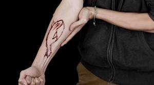 A picture of blue whale was drawn on his hand leading to the suspicion that Vignesh was prodded to death by the online game.(Representative Photo) A picture of blue whale was drawn on his hand leading to the suspicion that Vignesh was prodded to death by the online game.(Representative Photo)