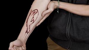The Blue Whale Challenge asks a user to perform various tasks, including carving a whale on their arm. (Representational Photo) The Blue Whale Challenge asks a user to perform various tasks, including carving a whale on their arm. (Representational Photo)