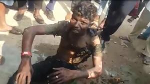 Cab driver Manikandan after his suicide attempt (Video grab) Cab driver Manikandan after his suicide attempt (Video grab)