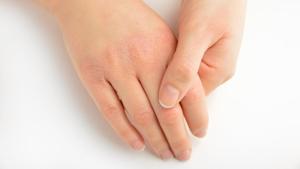 Although experts had initially linked the sound to the collapse of knuckle bubbles back in 1971, their findings were thrown into question after further studies showed there were still bubbles left in the fluid after the knuckles had been cracked.(Shutterstock) Although experts had initially linked the sound to the collapse of knuckle bubbles back in 1971, their findings were thrown into question after further studies showed there were still bubbles left in the fluid after the knuckles had been cracked.(Shutterstock)