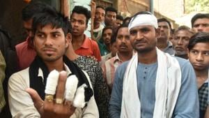 Injured Dalit youths Raju and Pradeep Jatav during the Bharat Bandh in Gwalior on Tuesday.(Mujeeb Faruqui/HT Photo) Injured Dalit youths Raju and Pradeep Jatav during the Bharat Bandh in Gwalior on Tuesday.(Mujeeb Faruqui/HT Photo)