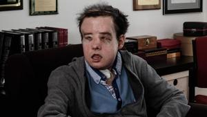 Jerome Hamon, the first man in the world to twice undergo a face transplant after flu tablets incompatible with his anti-rejection treatment led to the first attempt to fail, at the Hopital Europeen Georges-Pompidou in Paris.(AFP Photo) Jerome Hamon, the first man in the world to twice undergo a face transplant after flu tablets incompatible with his anti-rejection treatment led to the first attempt to fail, at the Hopital Europeen Georges-Pompidou in Paris.(AFP Photo)