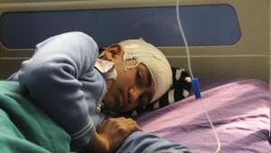 An injured student at the SMHS hospital, after a bus carrying 35 schoolchildren was attacked by stone-pelters in Shopian district, North Kashmir on May 2(Waseem Andrabi/Hindustan Times) An injured student at the SMHS hospital, after a bus carrying 35 schoolchildren was attacked by stone-pelters in Shopian district, North Kashmir on May 2(Waseem Andrabi/Hindustan Times)