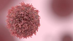 A cancerous tumour develops when cells proliferate at an abnormally high rate and agglomerate in healthy tissue.(Shutterstock) A cancerous tumour develops when cells proliferate at an abnormally high rate and agglomerate in healthy tissue.(Shutterstock)