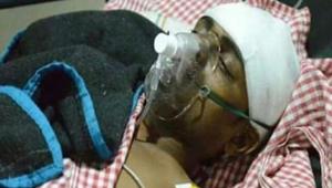 Mohammad Shakeel was allegedly attacked by a mob on suspicion of cow slaughter in Madhya Pradesh.(HT Photo) Mohammad Shakeel was allegedly attacked by a mob on suspicion of cow slaughter in Madhya Pradesh.(HT Photo)