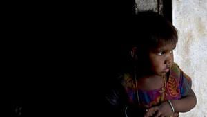 Stunted children’s growth and development is impaired. Such children are vulnerable to repeated infections that can also effect brain development, which can create learning problems.(AP File Photo) Stunted children’s growth and development is impaired. Such children are vulnerable to repeated infections that can also effect brain development, which can create learning problems.(AP File Photo)