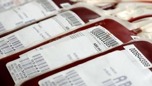 The blood available at the hospital will be irradiated by gamma rays (i.e., exposed to gamma rays) to prevent complications, especially in children undergoing blood transfusion.(FOR REPRESENTATION/HT FILE) The blood available at the hospital will be irradiated by gamma rays (i.e., exposed to gamma rays) to prevent complications, especially in children undergoing blood transfusion.(FOR REPRESENTATION/HT FILE)