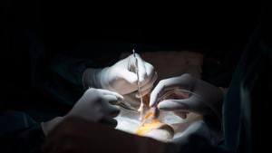 Doctors call for more lung donations to save people in dire need(HT Photo) Doctors call for more lung donations to save people in dire need(HT Photo)