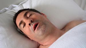 Obstructive sleep apnoea (OSA), common among elderly, is a condition where the walls of the throat relax and narrow during sleep, stopping breathing.(Shutterstock) Obstructive sleep apnoea (OSA), common among elderly, is a condition where the walls of the throat relax and narrow during sleep, stopping breathing.(Shutterstock)