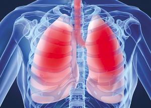 TB is a serious infectious disease that mainly affects lungs but can also affect bones, brain or other parts of the body.(Representative image) TB is a serious infectious disease that mainly affects lungs but can also affect bones, brain or other parts of the body.(Representative image)