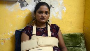 In the accident, the teacher fractured her right hand.(Rishikesh Choudhary) In the accident, the teacher fractured her right hand.(Rishikesh Choudhary)