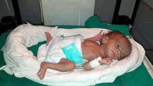 Newborn girl weighing 830 grams was admitted to neonatal intensive care unit (NICU) at the district hospital in Dholpur.(HT PHOTO) Newborn girl weighing 830 grams was admitted to neonatal intensive care unit (NICU) at the district hospital in Dholpur.(HT PHOTO)