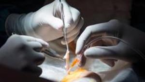 The woman died after her body rejected the kidney, said a hospital official.(AFP/Picture for representation) The woman died after her body rejected the kidney, said a hospital official.(AFP/Picture for representation)
