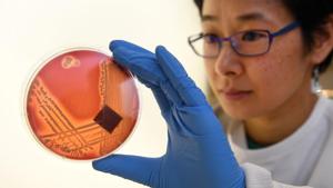 Jean Lee, a PhD student at Melbourne's Doherty Institute, inspects the superbug Staphylcocus epidermidis on an agar plate in Melbourne.(AFP) Jean Lee, a PhD student at Melbourne's Doherty Institute, inspects the superbug Staphylcocus epidermidis on an agar plate in Melbourne.(AFP)