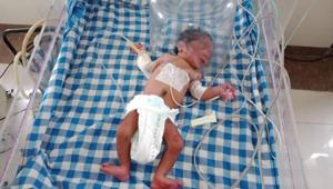 Seven days old girl baby undergoing treatment at civil hospital in Jalandhar.(HT Photo) Seven days old girl baby undergoing treatment at civil hospital in Jalandhar.(HT Photo)