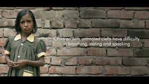 More than 30,000 babies are born in India with a cleft every year.(The Himalaya Drug Company) More than 30,000 babies are born in India with a cleft every year.(The Himalaya Drug Company)