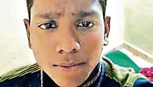 David Bangera, 15, who fractured his collar bone(HT Photo) David Bangera, 15, who fractured his collar bone(HT Photo)