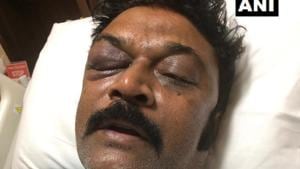 Both JN Ganesh and Anand Singh (pictured) are Congress MLAs from Ballari district. While Ganesh represents Kampali constituency, Singh represents Vijayanagar constituency.(ANI/Twitter) Both JN Ganesh and Anand Singh (pictured) are Congress MLAs from Ballari district. While Ganesh represents Kampali constituency, Singh represents Vijayanagar constituency.(ANI/Twitter)