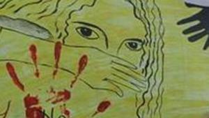 The police found burn marks all over the child’s body, including her face, stomach, back and hands.(AFP) The police found burn marks all over the child’s body, including her face, stomach, back and hands.(AFP)