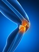Runner’s knee pain makes the muscles around the knee really weak(Shutterstock) Runner’s knee pain makes the muscles around the knee really weak(Shutterstock)