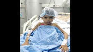 Six-year-old Suraj, the first patient at the Postgraduate Institute of Medical Education and Research .(HT Photo) Six-year-old Suraj, the first patient at the Postgraduate Institute of Medical Education and Research .(HT Photo)