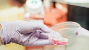 National Cancer Institute estimates, only 20% of patients diagnosed with EAC survive five years.(Unsplash) National Cancer Institute estimates, only 20% of patients diagnosed with EAC survive five years.(Unsplash)