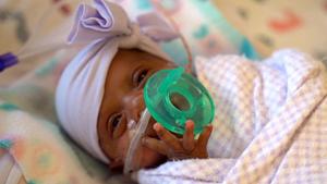 This March, 2019 photo provided by Sharp HealthCare in San Diego shows a baby named Saybie. Sharp Mary Birch Hospital for Women & Newborns said in a statement Wednesday, May 29, 2019, that Saybie, born at 23 weeks and three days, is believed to be the world's tiniest surviving baby, who weighed just 245 grams (about 8.6 ounces) before she was discharged as a healthy infant. She was sent home this month weighing 5 pounds (2 kilograms) after nearly five months in the hospital's neonatal intensive care unit. (Sharp HealthCare via AP)(AP) This March, 2019 photo provided by Sharp HealthCare in San Diego shows a baby named Saybie. Sharp Mary Birch Hospital for Women & Newborns said in a statement Wednesday, May 29, 2019, that Saybie, born at 23 weeks and three days, is believed to be the world's tiniest surviving baby, who weighed just 245 grams (about 8.6 ounces) before she was discharged as a healthy infant. She was sent home this month weighing 5 pounds (2 kilograms) after nearly five months in the hospital's neonatal intensive care unit. (Sharp HealthCare via AP)(AP)