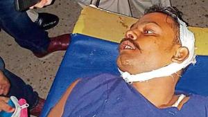 Undertrial prisoner Sumit Singh was referred to TMH from MGMMCH after his conditions deteriorated following clash between gangs inside Ghaghidih Central Jail in Jamshedpur.(Manoj Kumar/ Hindustan Times) Undertrial prisoner Sumit Singh was referred to TMH from MGMMCH after his conditions deteriorated following clash between gangs inside Ghaghidih Central Jail in Jamshedpur.(Manoj Kumar/ Hindustan Times)