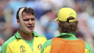 Australia's Alex Carey with a bandaged face in the ICC World Cup semi-final against England.(AP) Australia's Alex Carey with a bandaged face in the ICC World Cup semi-final against England.(AP)