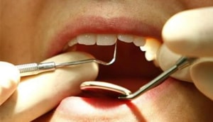 An X-ray and CT-scan of the boy’s lower right jaw showed a lot of rudimentary teeth following which the doctors decided on the surgery, said PSenthilnathan, Professor -Department of Oral and Maxillofacial Surgery at the hospital(Reuters/ Representative Image) An X-ray and CT-scan of the boy’s lower right jaw showed a lot of rudimentary teeth following which the doctors decided on the surgery, said PSenthilnathan, Professor -Department of Oral and Maxillofacial Surgery at the hospital(Reuters/ Representative Image)