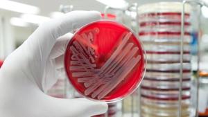 A hand with a medical glove is holding a agar plate with a culture of a pathogenic bacteria.(Representative) A hand with a medical glove is holding a agar plate with a culture of a pathogenic bacteria.(Representative)