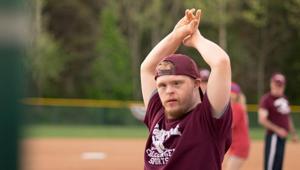 Children with arthropathy of Down syndrome often present with significant joint damage and disability at diagnosis.(Unsplash) Children with arthropathy of Down syndrome often present with significant joint damage and disability at diagnosis.(Unsplash)