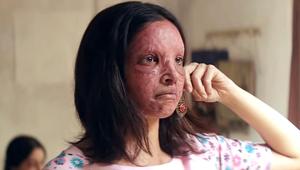 Deepika Padukone plays an acid attack survivor in Chhapaak. Deepika Padukone plays an acid attack survivor in Chhapaak.
