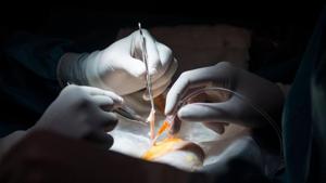 A 12-year-old boy got a new lease of life after doctors at the state-run hospital here removed a pen cap from his lungs. (Representative Image)(AFP) A 12-year-old boy got a new lease of life after doctors at the state-run hospital here removed a pen cap from his lungs. (Representative Image)(AFP)
