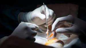 The moment a decision was made to harvest the baby’s organs, doctors moved quickly to perform the rare and complicated six-hour surgery.(Representative photo) The moment a decision was made to harvest the baby’s organs, doctors moved quickly to perform the rare and complicated six-hour surgery.(Representative photo)