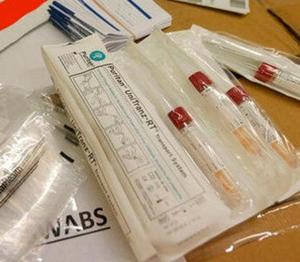 The investigation was carried out by testing samples of patients afflicted with other severe illnesses that make them vulnerable to the Covid-19 infection. The investigation was carried out by testing samples of patients afflicted with other severe illnesses that make them vulnerable to the Covid-19 infection.