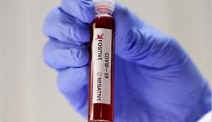 Fake blood is seen in test tubes labelled with the coronavirus (COVID-19) in this illustration taken March 17, 2020.(Reuters/ Image for representation) Fake blood is seen in test tubes labelled with the coronavirus (COVID-19) in this illustration taken March 17, 2020.(Reuters/ Image for representation)