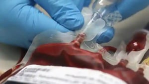 The basis for convalescent plasma therapy is simple: plasma – a component of the blood – from a recovered patient carries the specific antibodies that can neutralise the Sars-Cov-2 virus.(Photo: Shutterstock) The basis for convalescent plasma therapy is simple: plasma – a component of the blood – from a recovered patient carries the specific antibodies that can neutralise the Sars-Cov-2 virus.(Photo: Shutterstock)