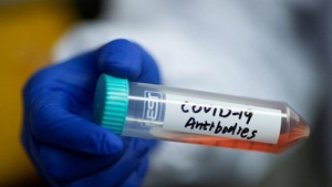 Over 2,231,438 people have been infected with Covid-19 worldwide.(Reuters) Over 2,231,438 people have been infected with Covid-19 worldwide.(Reuters)