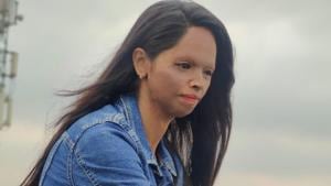 Acid attack survivor Laxmi Agarwal stands by women in distress Acid attack survivor Laxmi Agarwal stands by women in distress