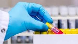 A laboratory worker removes a test tube containing a patient's sample from a box during coronavirus detection tests in the virology research labs.(Bloomberg) A laboratory worker removes a test tube containing a patient's sample from a box during coronavirus detection tests in the virology research labs.(Bloomberg)