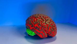 The circuit begins in deep brain areas, called the dorsal peduncular cortex and the dorsal tenia tecta (DP/DTT), that send stress signals to the hypothalamus, a small region in the brain that controls the body’s vital functions.(Unsplash) The circuit begins in deep brain areas, called the dorsal peduncular cortex and the dorsal tenia tecta (DP/DTT), that send stress signals to the hypothalamus, a small region in the brain that controls the body’s vital functions.(Unsplash)