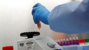 It said that Indian and other non-white males are 4.2 times more likely to die from a Covid-19-related death and non-white females are 4.3 times more likely than white ethnicity males and females.(REUTERS) It said that Indian and other non-white males are 4.2 times more likely to die from a Covid-19-related death and non-white females are 4.3 times more likely than white ethnicity males and females.(REUTERS)