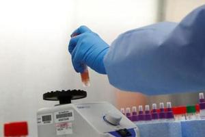 84 Covid-19 patients recovered and were discharged from Pune city hospitals, said officials.(REUTERS/ REPRESENTATIVE PHOTO) 84 Covid-19 patients recovered and were discharged from Pune city hospitals, said officials.(REUTERS/ REPRESENTATIVE PHOTO)