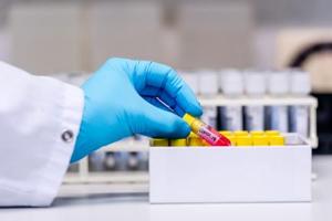 Amritsar topped the chart with 20 fresh cases followed by Ludhiana nine, Jalandhar eight, Patiala four, Gurdaspur three, Kapurthala and Tarn Taran two each, and one each in Bathinda, Faridkot and Moga and Muktsar.(Bloomberg) Amritsar topped the chart with 20 fresh cases followed by Ludhiana nine, Jalandhar eight, Patiala four, Gurdaspur three, Kapurthala and Tarn Taran two each, and one each in Bathinda, Faridkot and Moga and Muktsar.(Bloomberg)