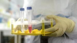 The drug will be available as a prescription-based medication for Rs 103/tablet, with recommended dose being 1,800 mg twice on day one, followed by 800 mg twice daily up to day 14.(Bloomberg) The drug will be available as a prescription-based medication for Rs 103/tablet, with recommended dose being 1,800 mg twice on day one, followed by 800 mg twice daily up to day 14.(Bloomberg)