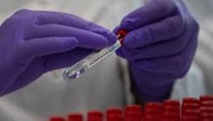 In the initial stage of the trial, 15 healthy volunteers are receiving the vaccine – starting with a low dose and escalating to increasingly higher doses for subsequent volunteers – to assess safety and to find the optimal dosage.(AP) In the initial stage of the trial, 15 healthy volunteers are receiving the vaccine – starting with a low dose and escalating to increasingly higher doses for subsequent volunteers – to assess safety and to find the optimal dosage.(AP)